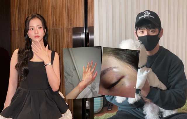 내 동생이 또 가정폭력을 퍼뜨린다! 형수는 "강제로 가래를 삼키고 성교를 당했다"며 끔찍한 부상 사진을 올렸다. 지수는 비극적인 연루에 빠졌다… 과거 그녀는 “내 인... 대표 이미지