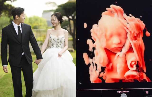 FT아일랜드 전 멤버 송승현이 아빠가 됐다는 소식을 전했다. '나의 작은 태양' 고백하는 초음파 사진 공개 너무 훈훈하네요 대표 이미지